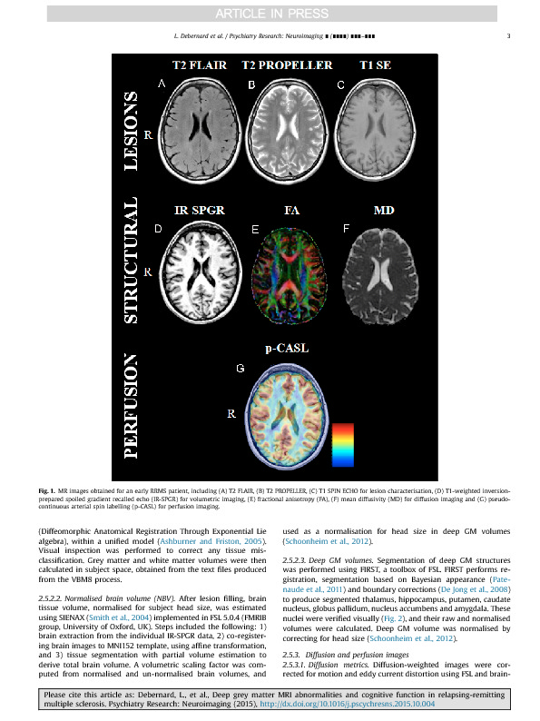 Download Deep grey matter MRI abnormalities and cognitive function in relapsing-remitting multiple sclerosis.