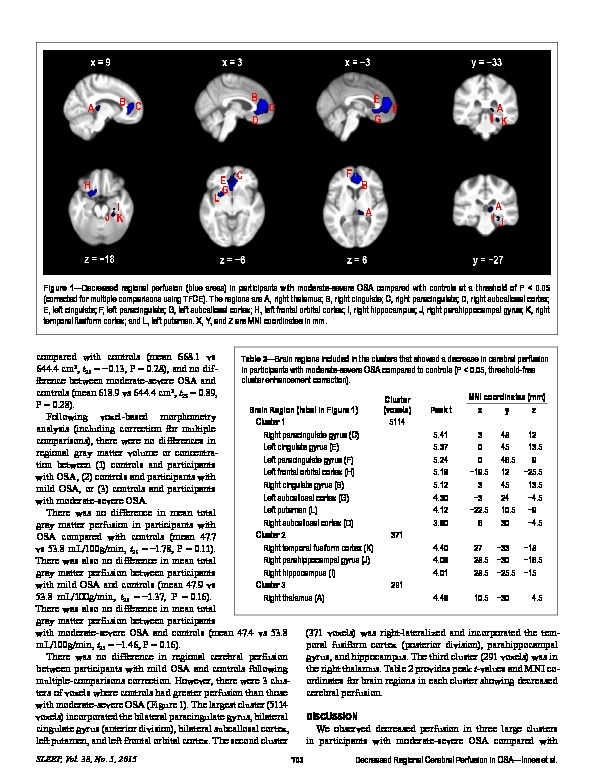 Download Decreased regional cerebral perfusion in moderate-severe obstructive sleep apnoea during wakefulness.
