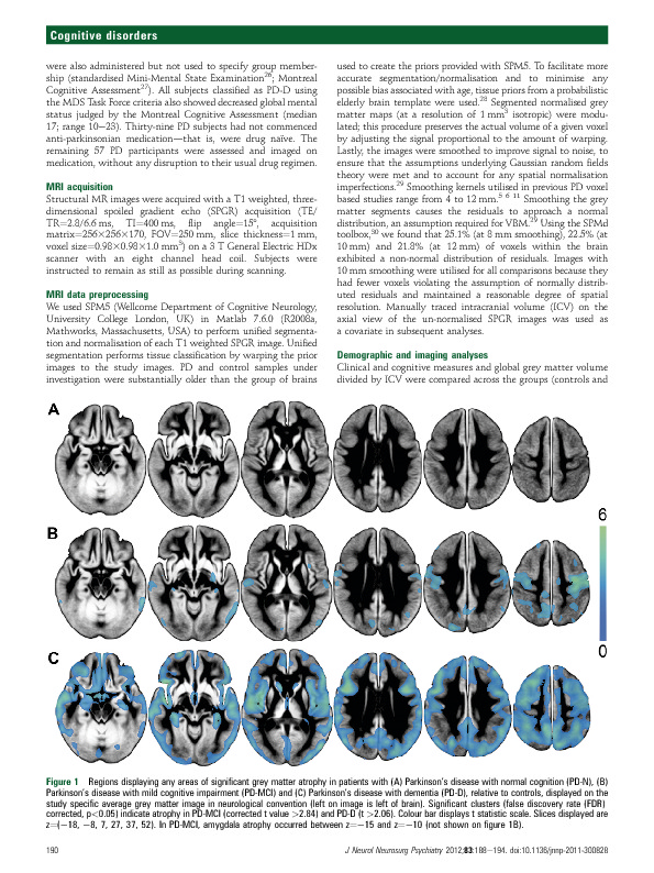 Download Grey matter atrophy in cognitively impaired Parkinson’s disease.