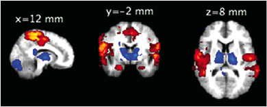 Microsleep - fMRI Microsleep - fMRI