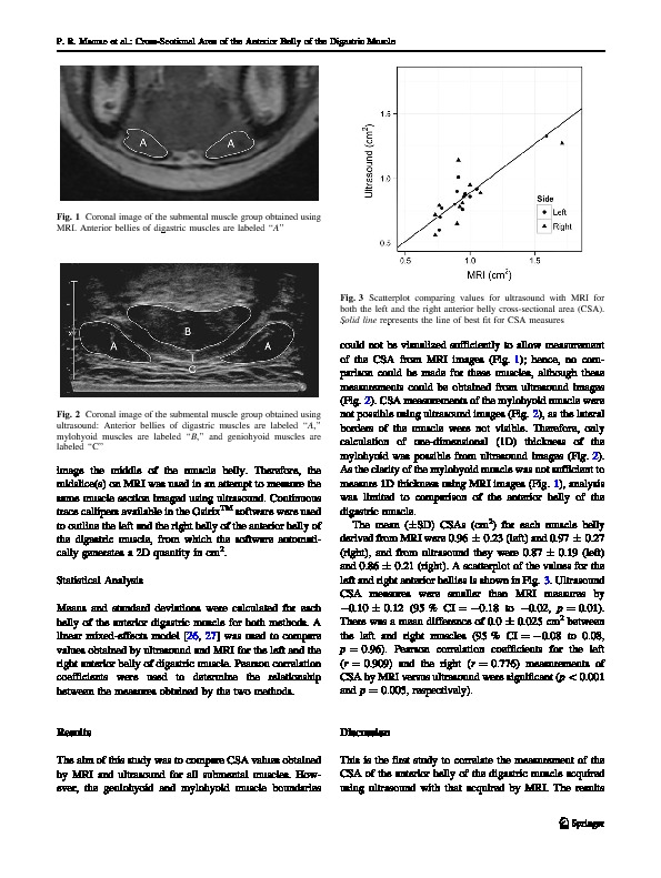 Download Cross-Sectional Area of the Anterior Belly of the Digastric Muscle: Comparison of MRI and Ultrasound Measures.