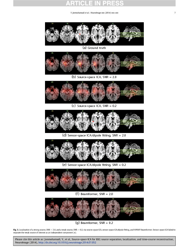 Download Source-Space ICA for EEG Source Separation, Localization, and Time-Course Reconstruction.