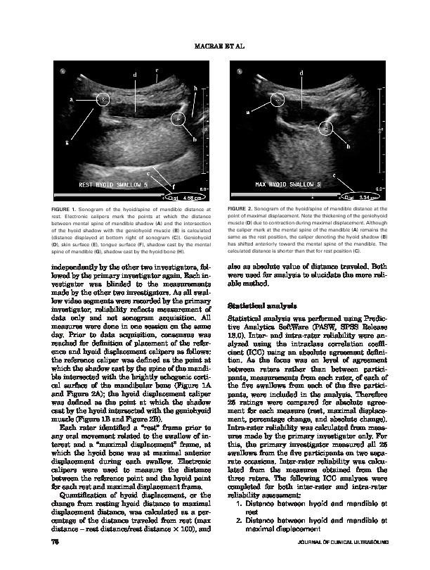 Download Intra- and inter-rater reliability for analysis of hyoid displacement measured with sonography.