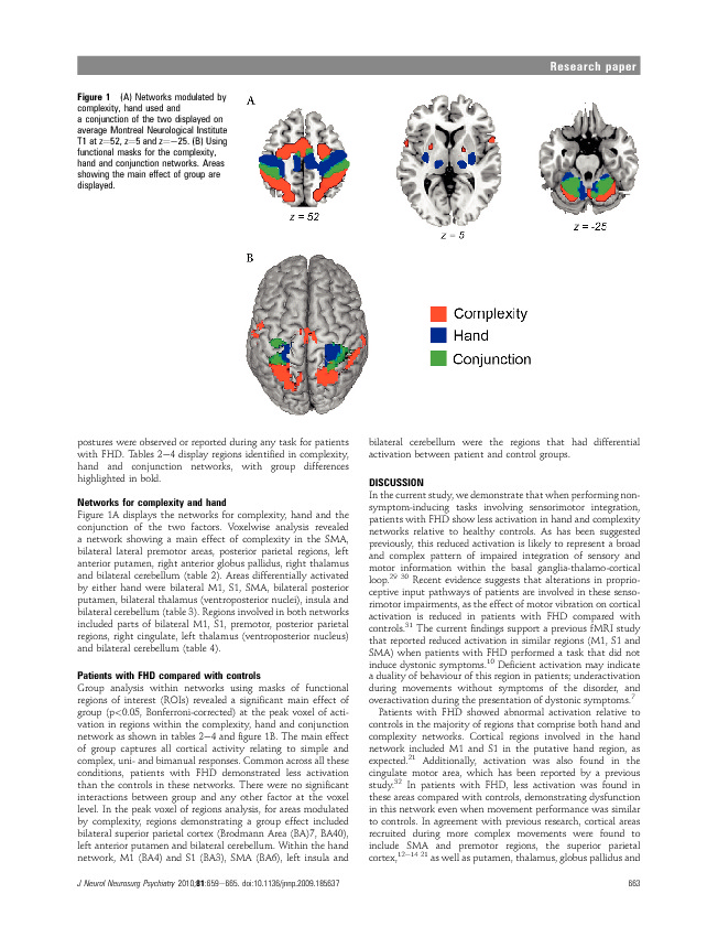 Download Impaired sensorimotor integration in focal hand dystonia patients in the absence of symptoms.