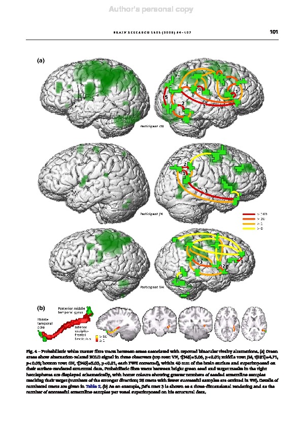 Download Frontoparietal activity and its structural connectivity in binocular rivalry.