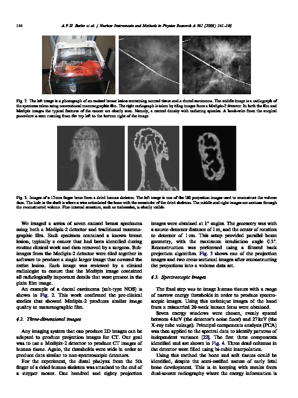 Download Bio-medical X-ray imaging with spectroscopic pixel detectors.