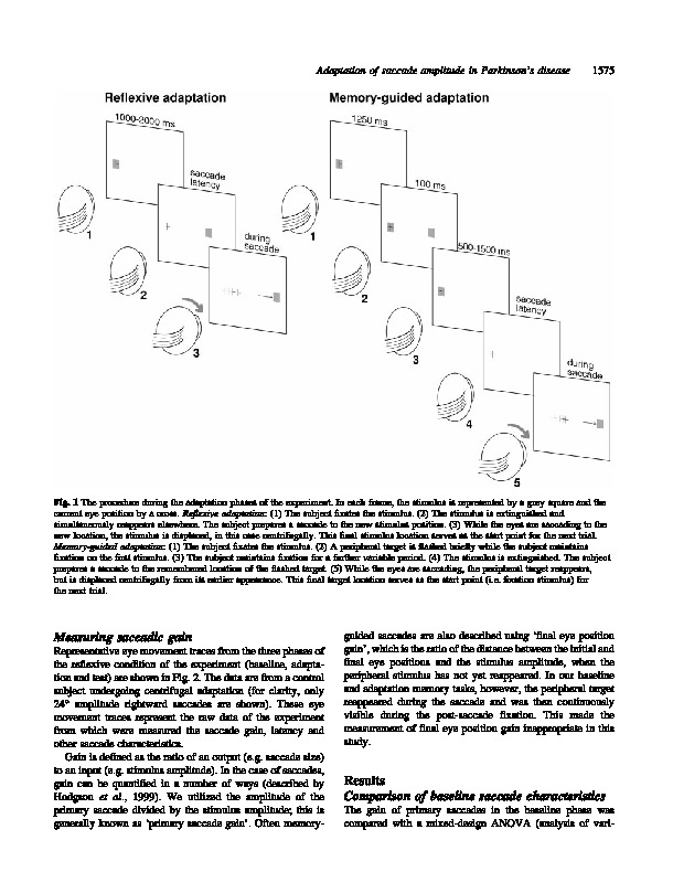 Download Adaptive modification of saccade amplitude in Parkinson’s disease.