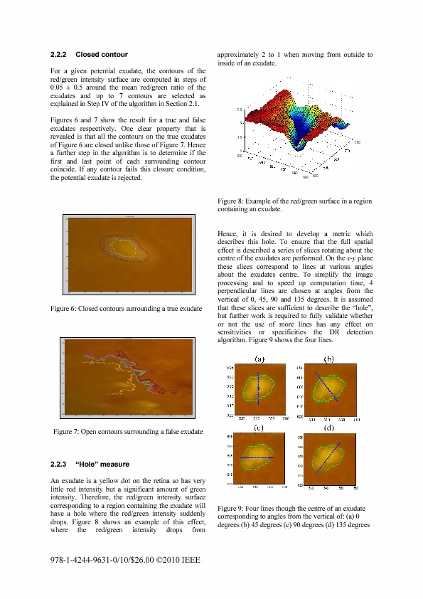 Download Diabetic retinopathy detection using geometrical techniques related to the underlying physiology.