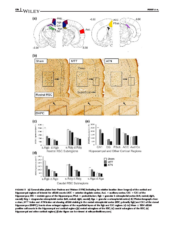 Download Anterior thalamic nuclei lesions have a greater impact than mammillothalamic tract lesions on the extended hippocampal system.