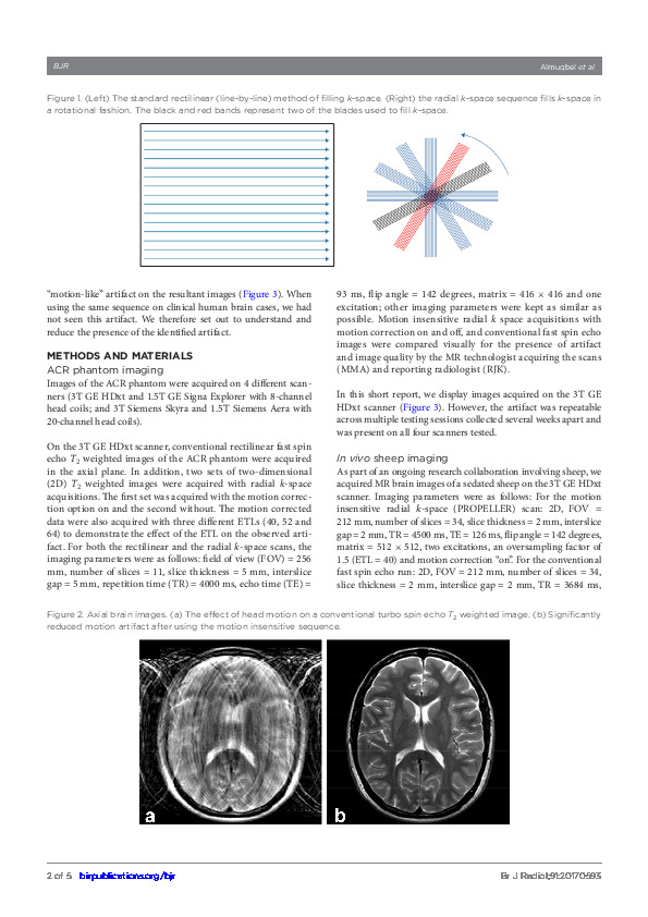 Download Practical implications of motion correction with motion insensitive radial k-space acquisitions in MRI.