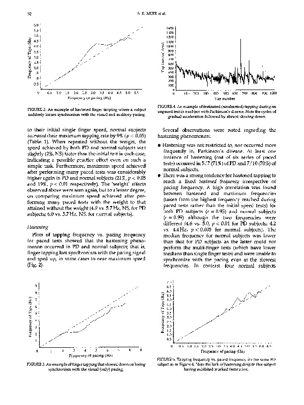 Download Measurement and analysis of single and multiple finger tapping in normal and Parkinsonian subjects.