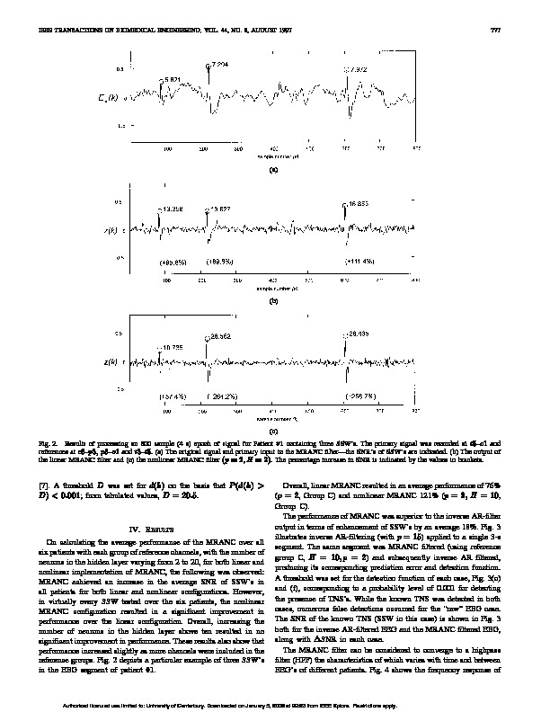 Download Multireference adaptive noise cancelling applied to the EEG.