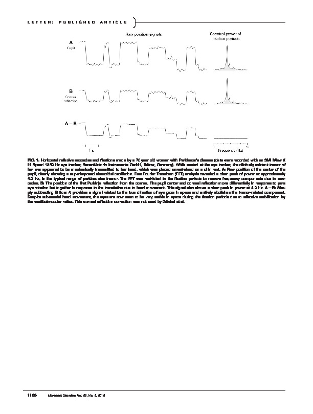 Download "Ocular Tremor" in Parkinson’s Disease: A Technology-dependent Artifact of Universal Head Motion?