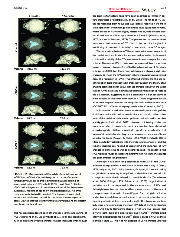 Download Computed tomography provides enhanced techniques for longitudinal monitoring of progressive intracranial volume loss associated with regional neurodegeneration in ovine neuronal ceroid lipofuscinoses.