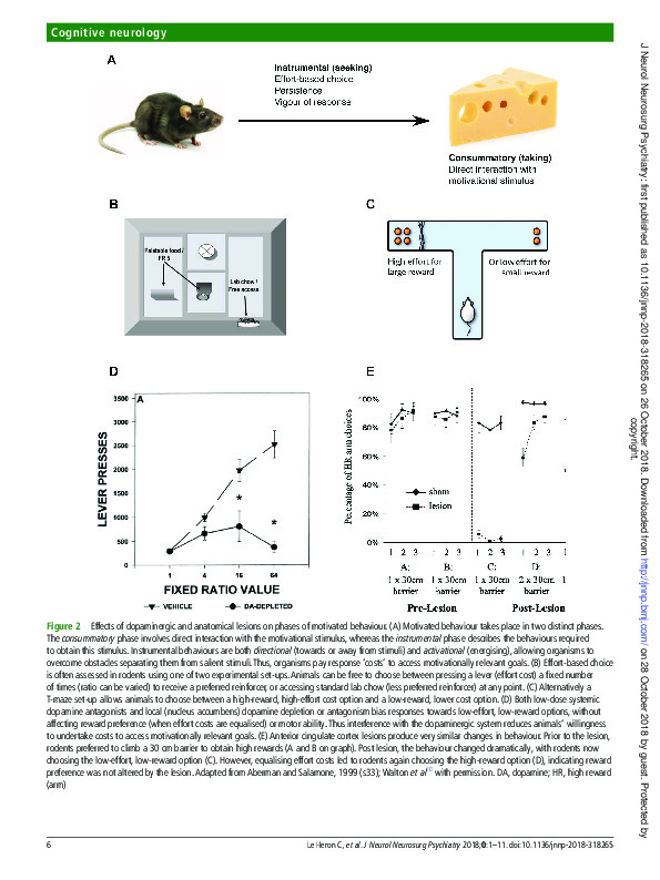 Download Brain mechanisms underlying apathy.