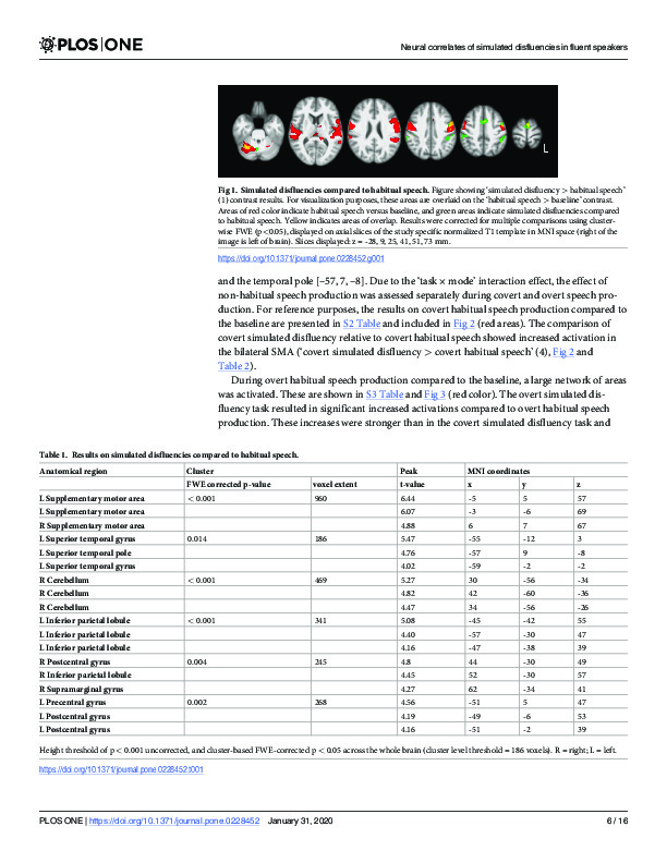 Download Brain activation during non-habitual speech production: Revisiting the effects of simulated disfluencies in fluent speakers.