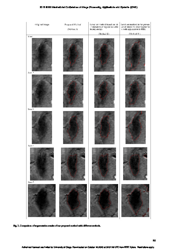 Download Segmentation of substantia nigra for the automated characterization of Parkinson’s disease.