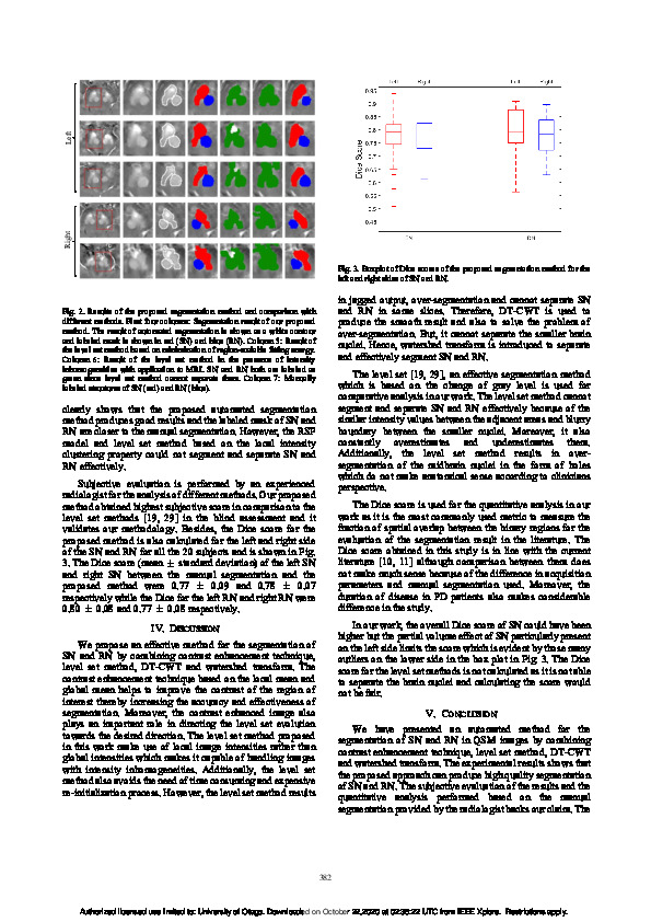 Download Automated segmentation of substantia nigra and red nucleus in quantitative susceptibility mapping images.