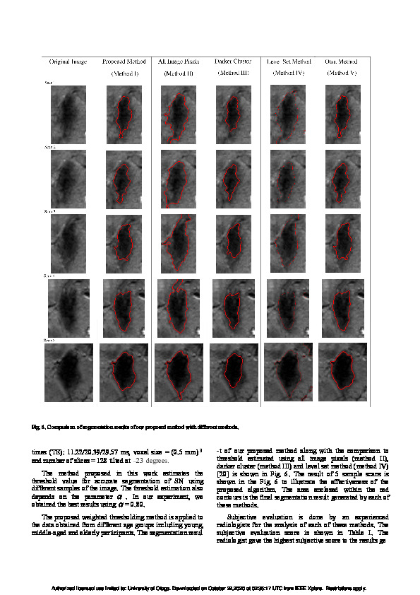 Download Segmentation of substantia nigra using weighted thresholding method, In 2018 International Conference on Image and Vision Computing New Zealand (IVCNZ) (pp.
