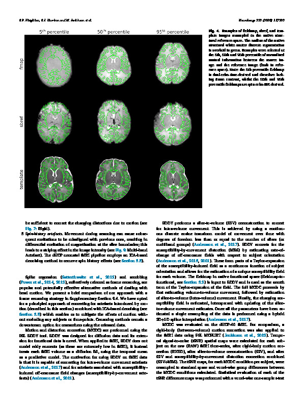 Download The developing Human Connectome Project (dHCP) automated resting-state functional processing framework for newborn infants.