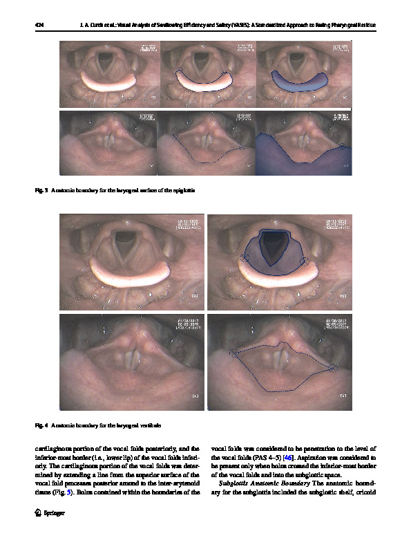 Download Visual analysis of swallowing efficiency and safety (VASES): A standardized approach to rating pharyngeal residue, penetration, and aspiration during FEES.