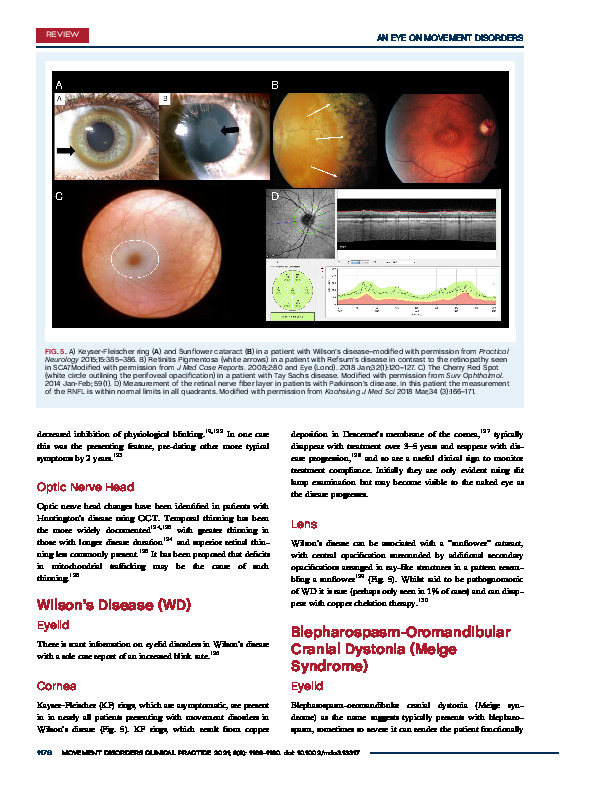 Download An eye on movement disorders.