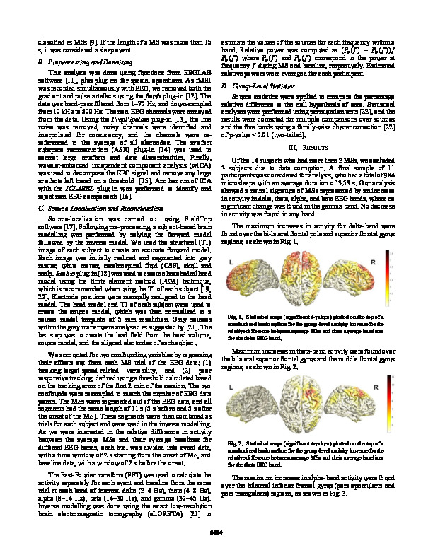 Download Investigating the neural signature of microsleeps using EEG.