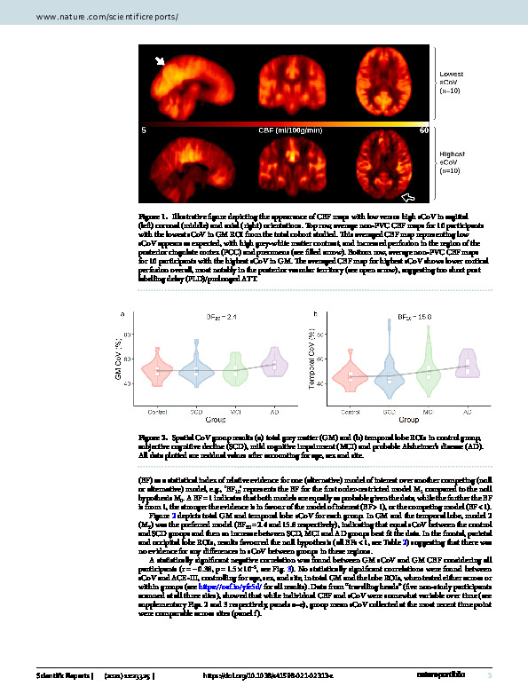 Download Spatial variation of perfusion MRI reflects cognitive decline in mild cognitive impairment and early dementia.