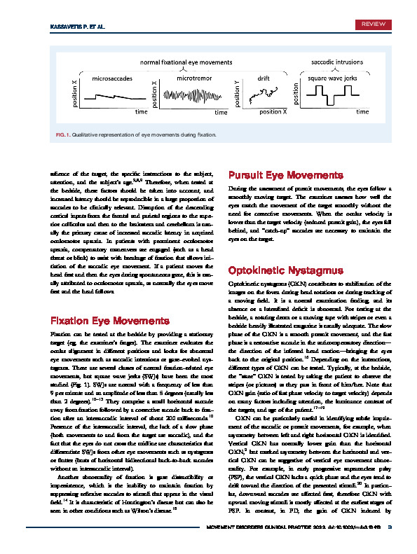 Download Eye movement disorders in movement disorders.