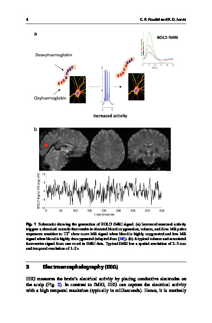 Download Multimodal neuroimaging with simultaneous fMRI and EEG. In N. V. Thakor (Ed.),.