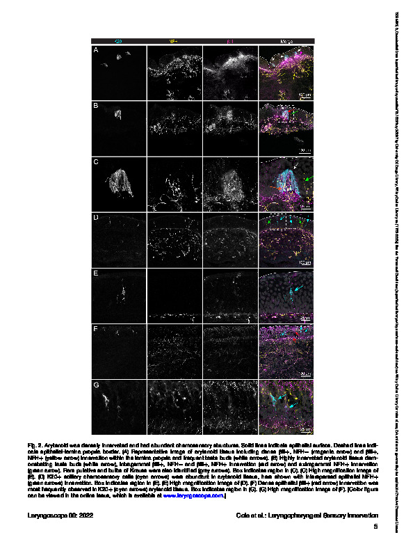 Download Healthy human laryngopharyngeal sensory innervation density correlates with age.