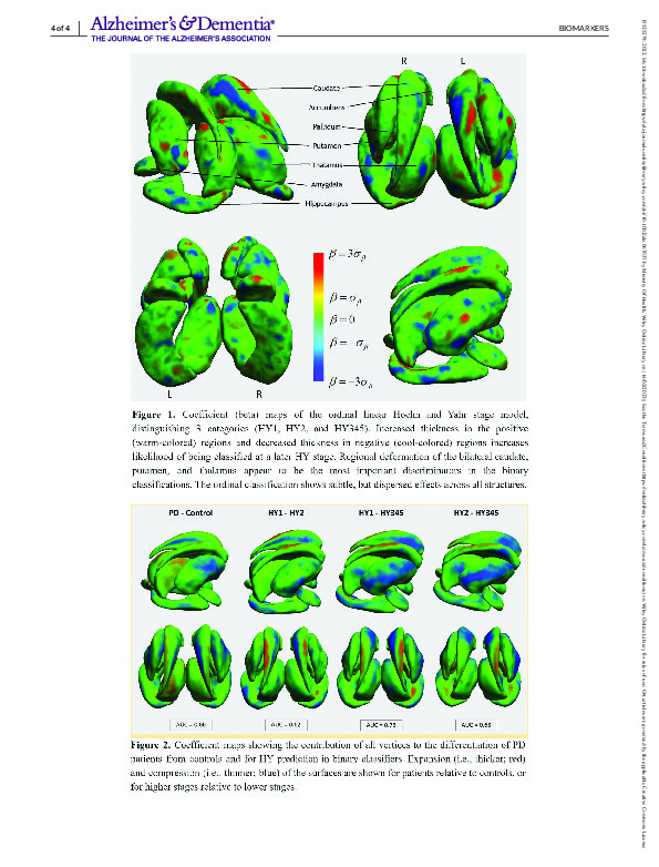 Download TV‐L1 Ordinal Logistic Regression Reveals New Morphometric Patterns Related to Parkinsonian Symptom Severity: An ENIGMA‐PD study.