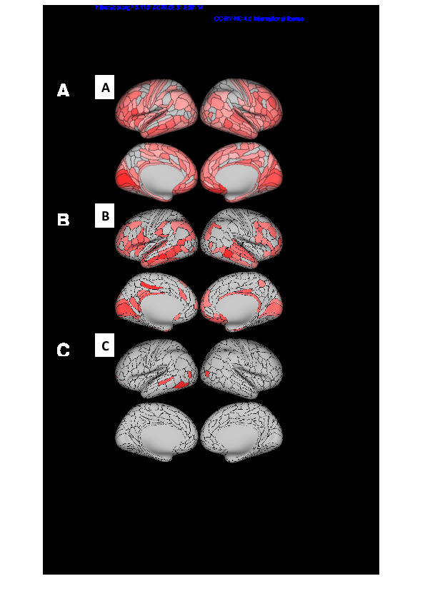 Download Associations between thinner retinal neuronal layers and suboptimal brain structural integrity: Are the eyes a window to the brain?