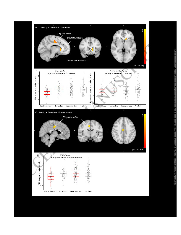Download Altered nucleus accumbens functional connectivity precedes apathy in Parkinson’s disease.
