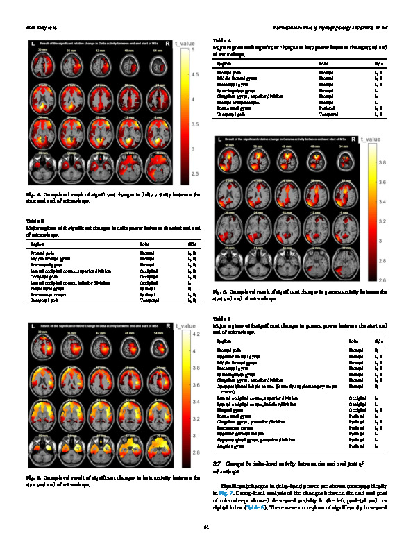 Download Increased cerebral activity during microsleeps reflects an unconscious drive to re-establish consciousness.