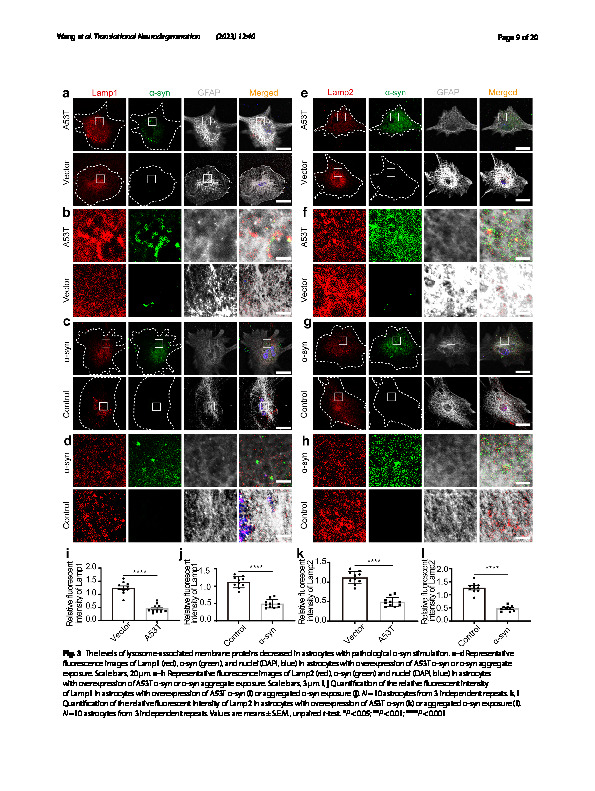 Download Wang, P., Lan, G., Xu, B., Yu, Z., Tian, C., Lei, X., ... & Zhang, J. (2023). α-Synuclein-carrying astrocytic extracellular vesicles in Parkinson pathogenesis and diagnosis.