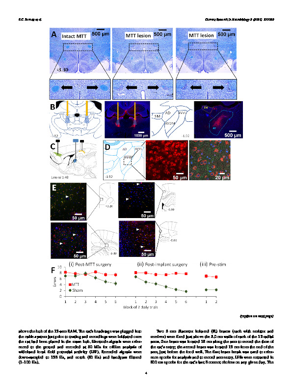 Download Anterior thalamic nuclei neurons sustain memory.