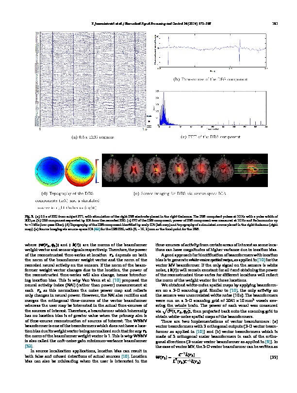 Download Comparison of beamformers for EEG source signal reconstruction.