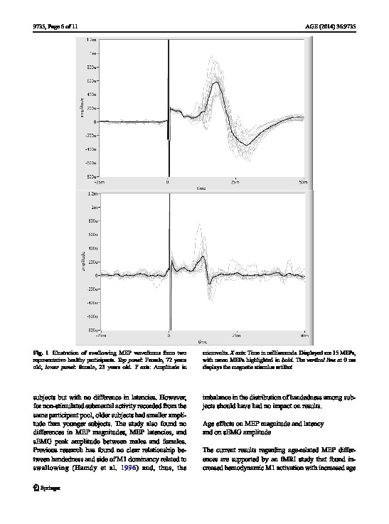 Download Age and gender effects on submental motor-evoked potentials.